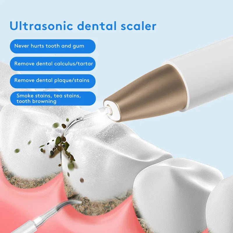 Gold-coloured handheld ultrasonic tooth cleaning device for removing tartar and stains.