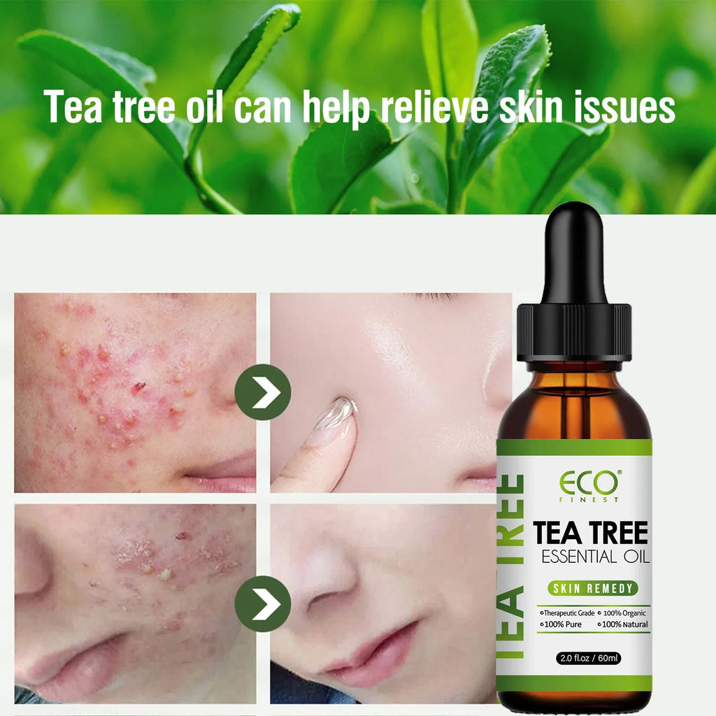 60ml bottle of Australian tea tree essential oil for skincare