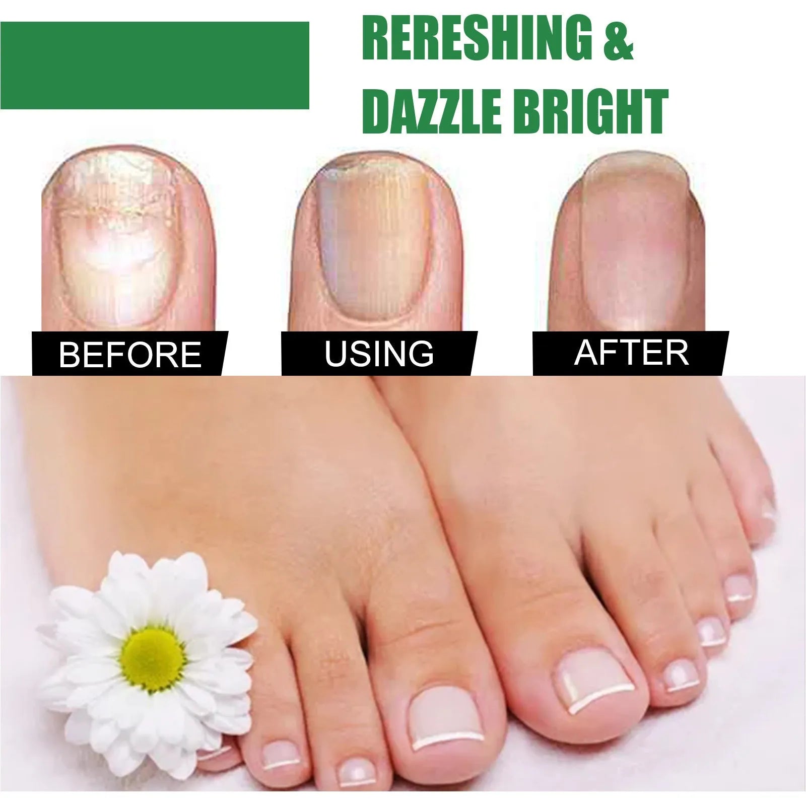 30ml bottle of tea tree oil nail repair solution for thickened hand and foot nails
