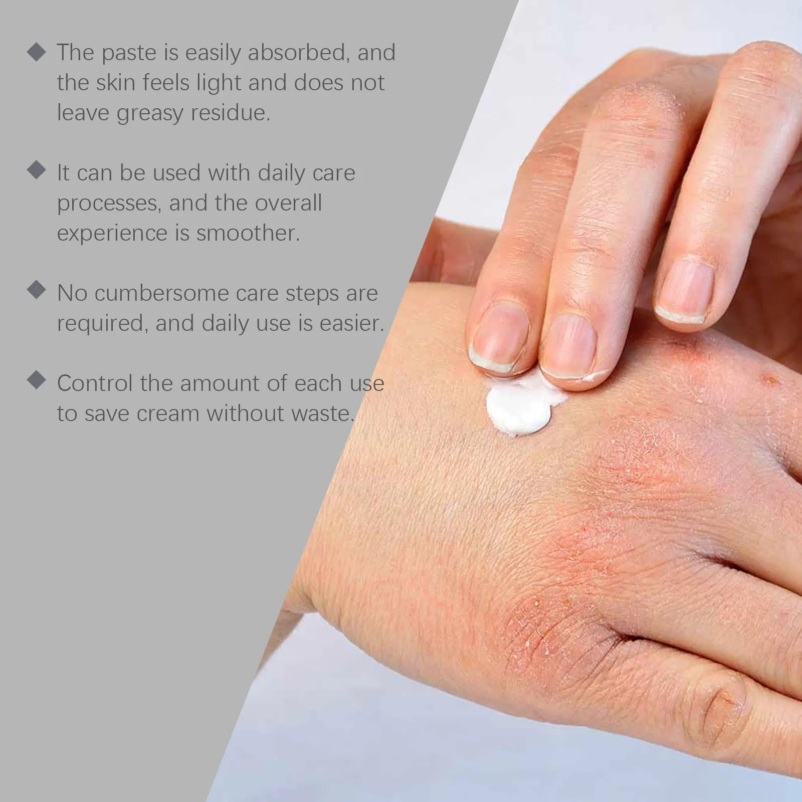 White pot of gentle soothing skin neck cream with Bifidobacterium animal milk and mint leaf, 75g