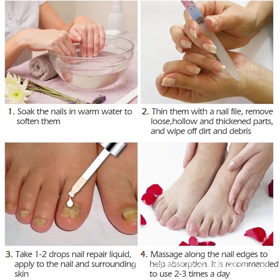 Deck Liquid Antimicrobial 10ml bottle for toenail fungal treatment and discolouration