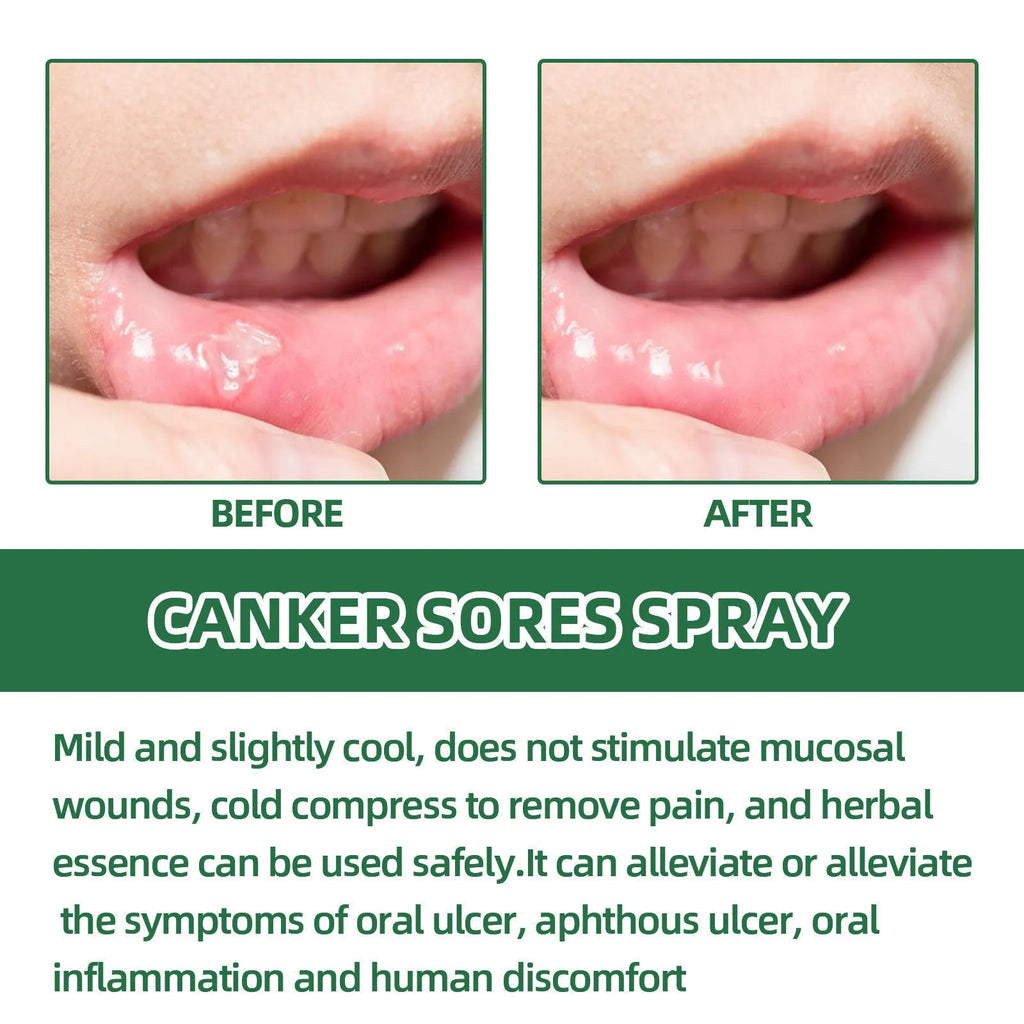 Mint flavoured breath cleaning oral care spray in a 20ml boxed bottle