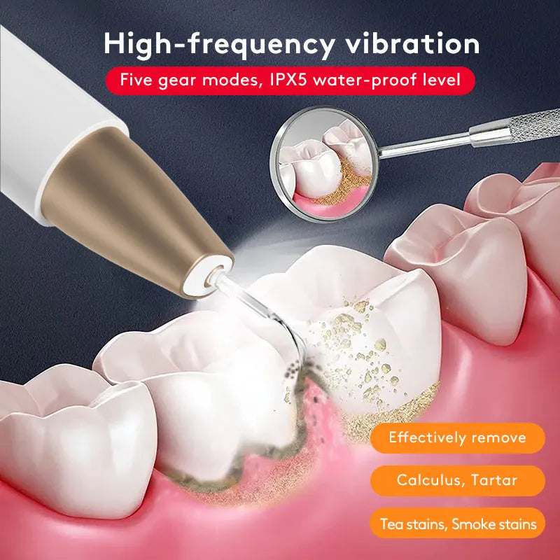 Gold-coloured handheld ultrasonic tooth cleaning device for removing tartar and stains.