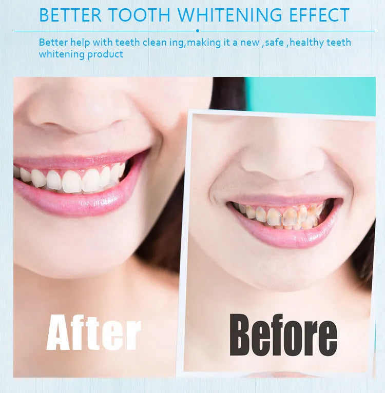 Teeth whitening pen with aluminium case in multiple colours, 1-4ml gel applicator for adults