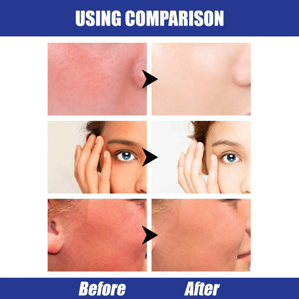 Hyaluronic Acid Sun Block Stick 22g waterproof SPF50 sunscreen in stick form