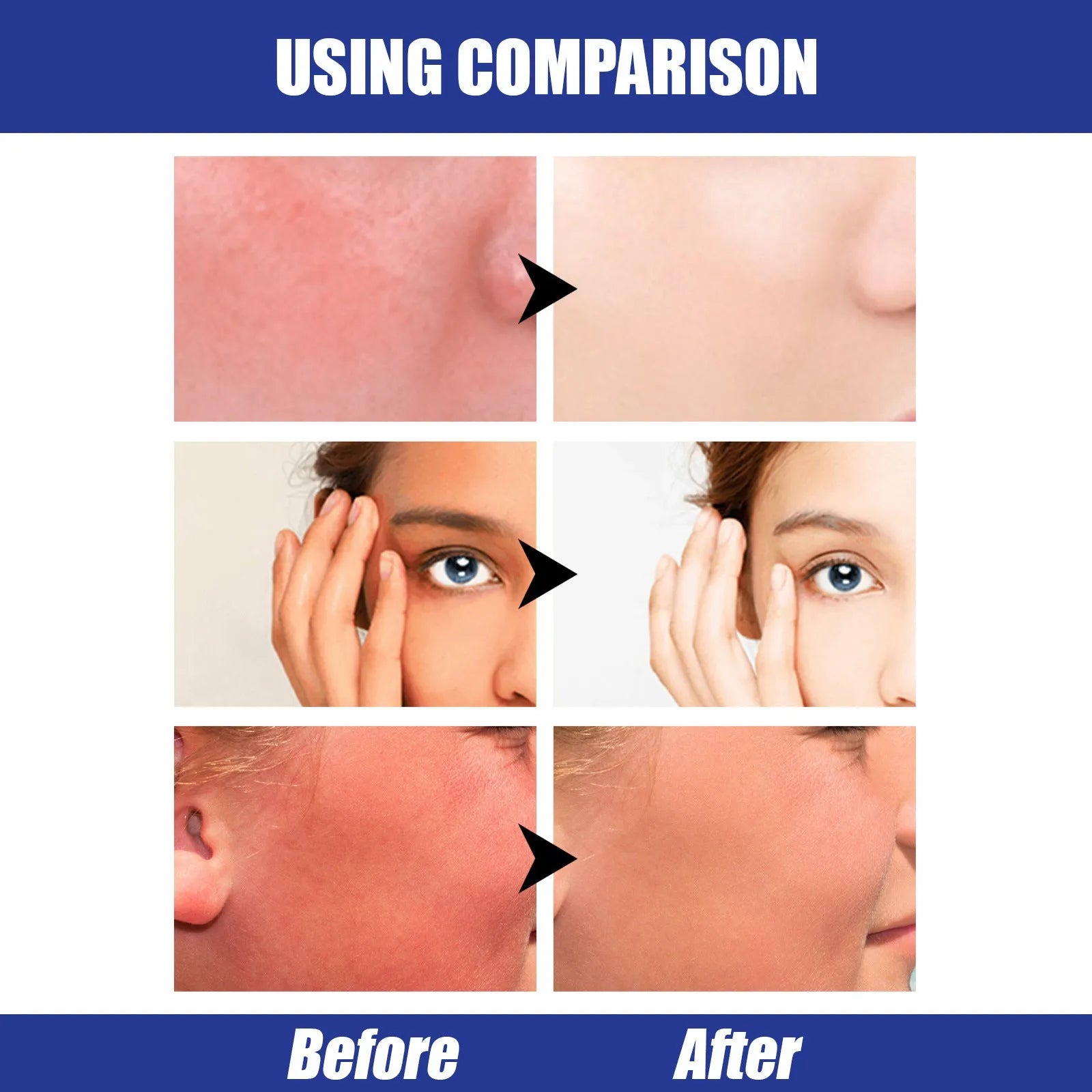 Hyaluronic Acid Sun Block Stick 22g waterproof SPF50 sunscreen in stick form