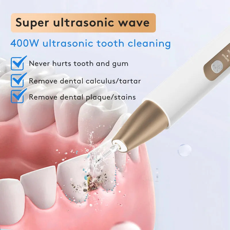 Gold-coloured handheld ultrasonic tooth cleaning device for removing tartar and stains.