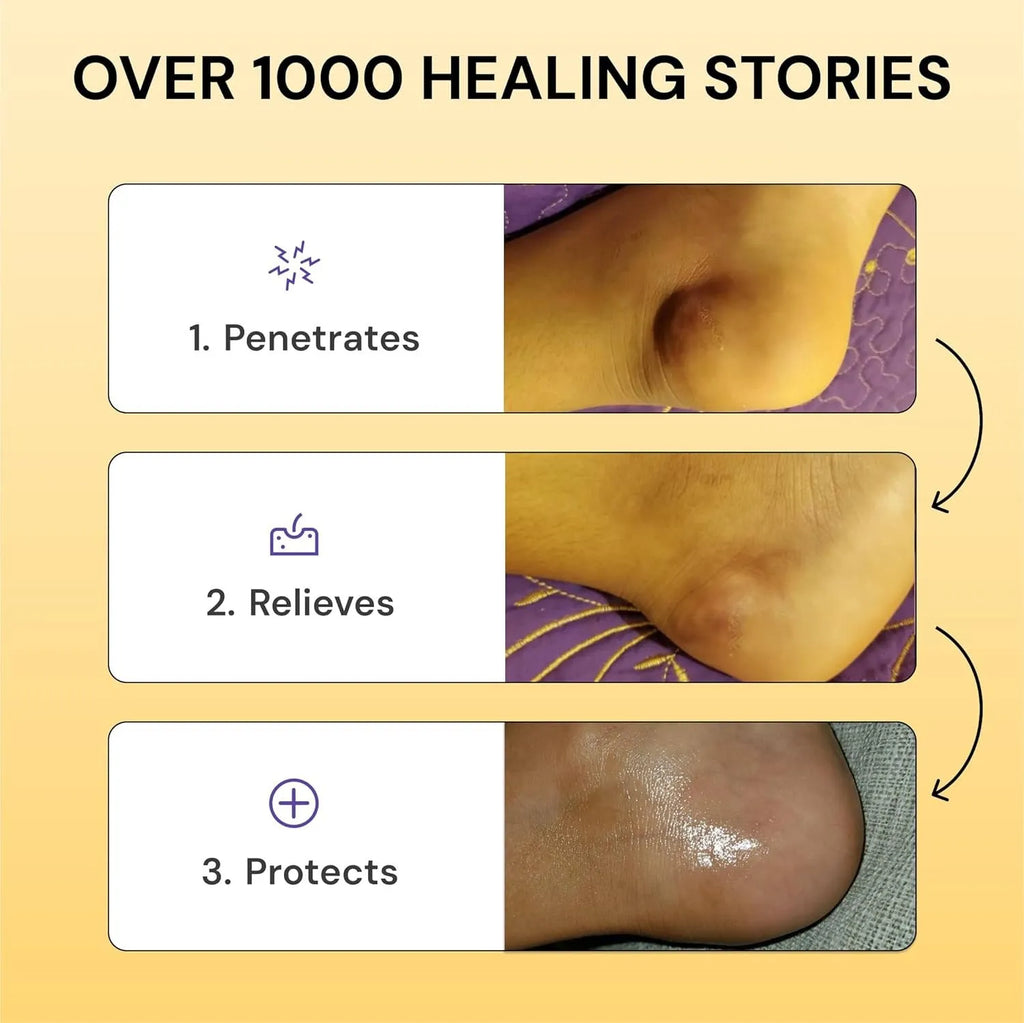 Universal Flare Care pain relief cream tube containing 120g of topical analgesic ointment for muscle and joint discomfort.