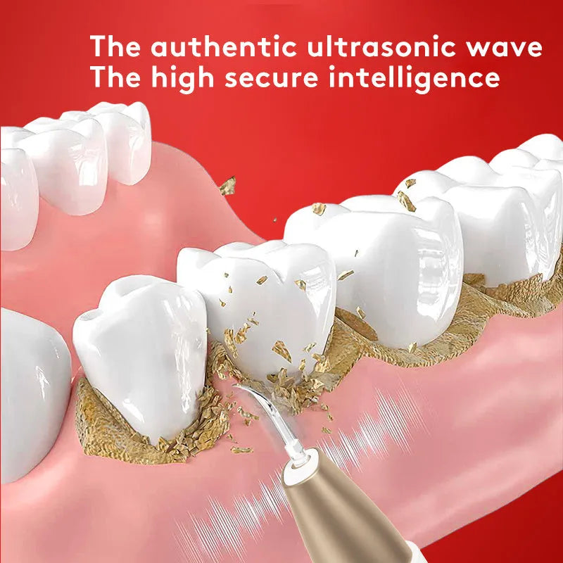 Gold-coloured handheld ultrasonic tooth cleaning device for removing tartar and stains.
